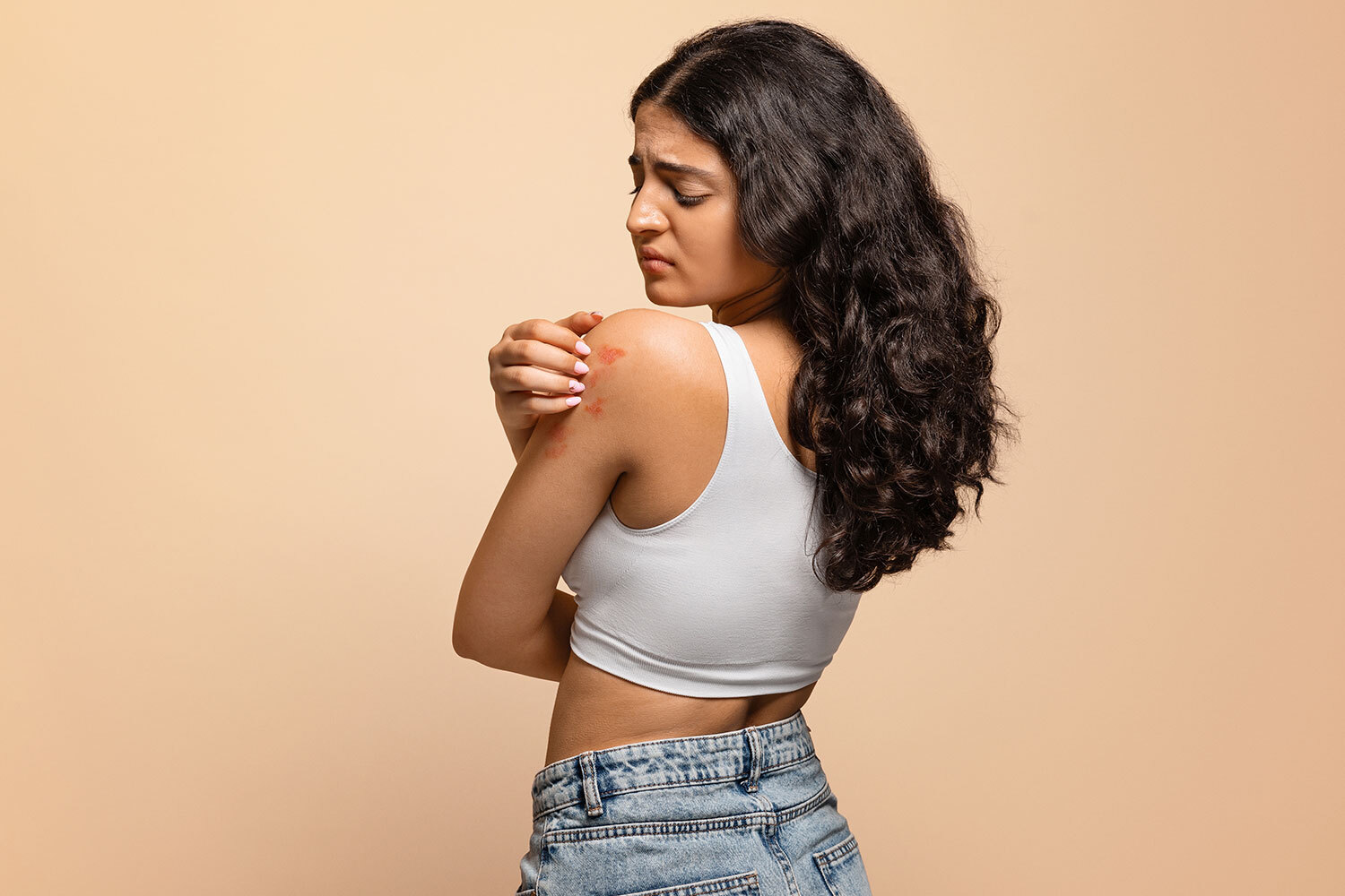 Understanding Atopic Dermatitis: Causes, Symptoms, and Effective Management